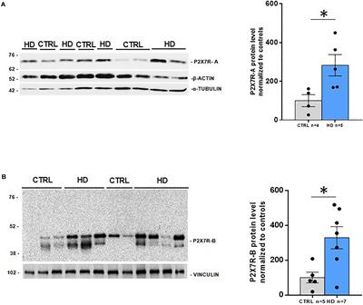 P2X7 <mark class="highlighted">Receptor Upregulation</mark> in Huntington’s Disease Brains